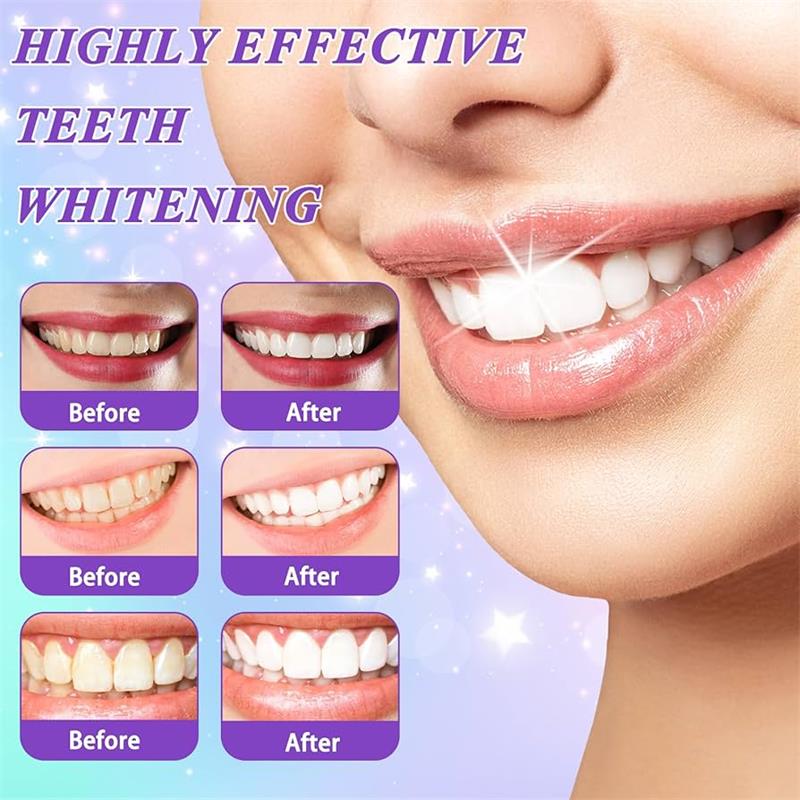 Pasta Gigi Pemutih Gigi Ungu 9 - Teeth Whitening Naturally ulasan dan harga