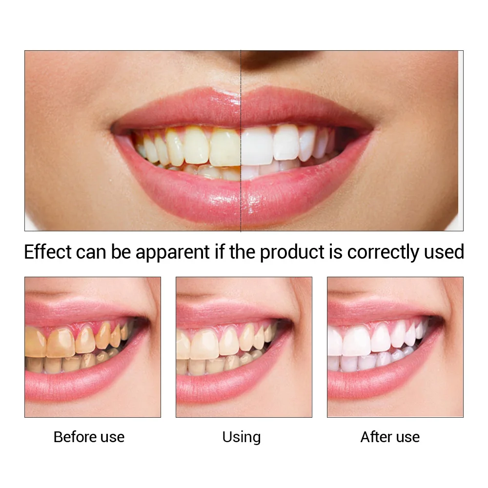 FTEENPLY Bubuk Esensi Pemutih  - Teeth Whitening Natural ulasan dan harga