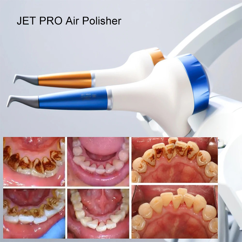 VV Dental Air Polishing Prophy - Teeth Whitening China ulasan dan harga