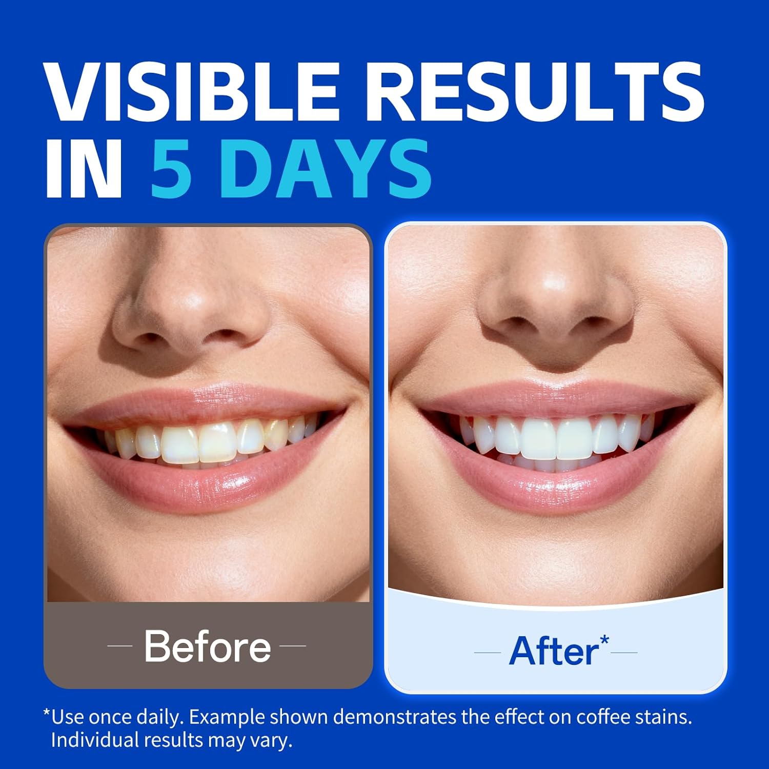 KHAZIX Strip Pemutih Gigi 7 pa - Teeth Whitening Oil Pulling ulasan dan harga